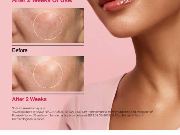 Anua Niacinamide 10% + TXA 4% Serum - 30ml New product image