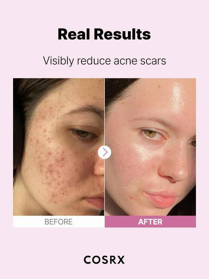 COSRX The Niacinamide 15 Serum product image
